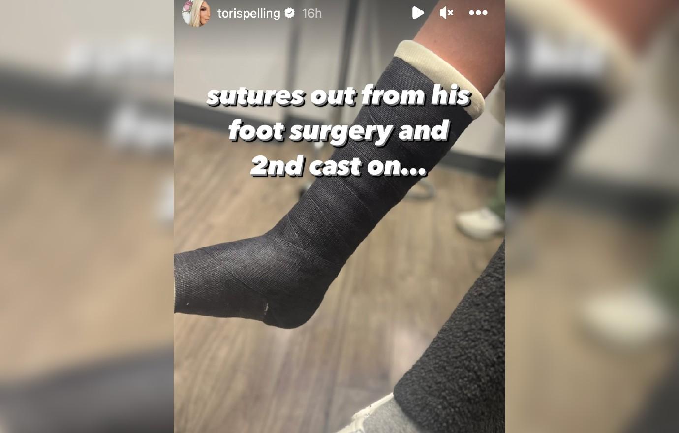 tori spelling urgent care