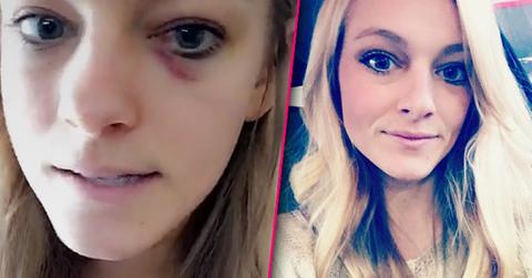 Teen mom mackenzie mckee snapchat bruise h