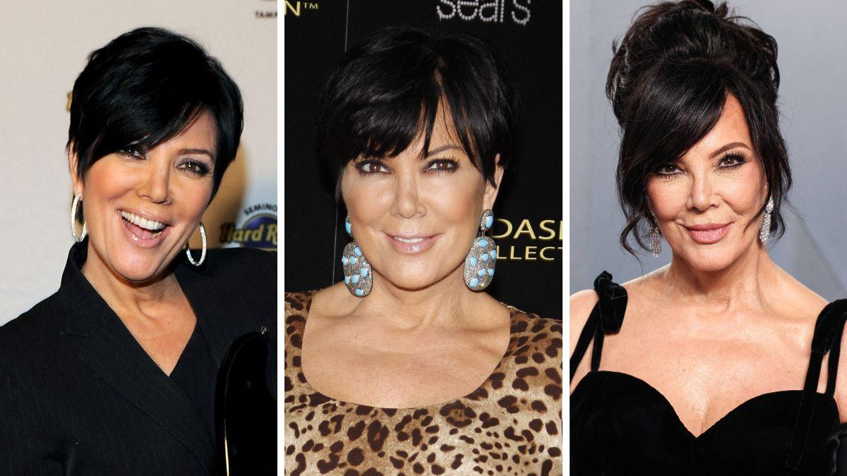 celebrities who got facelifts before after photos