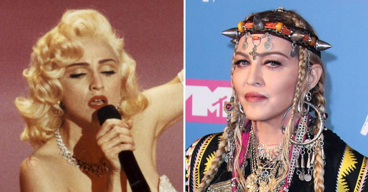 Madonna Looks 'Unrecognizable' Now—A Plastic Surgeon Weighs In: 'At Least  12 Cosmetic Procedures