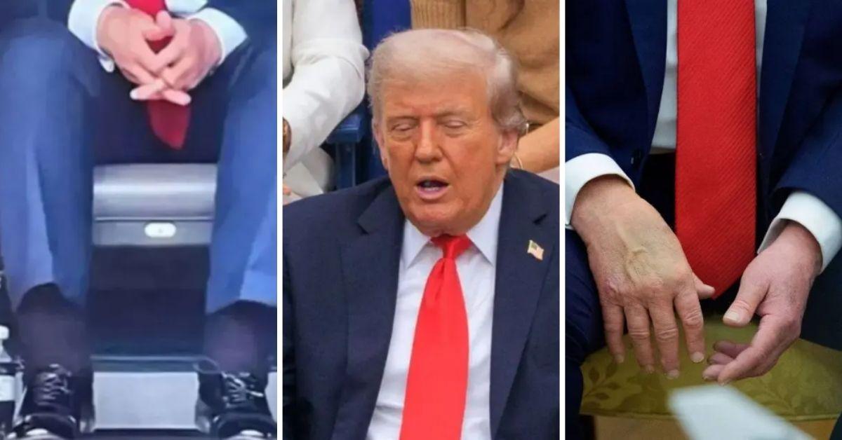 image of A former White House doctor questioned Donald Trump’s recent hospital visit.