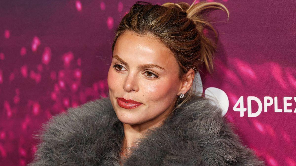 image of The model recently dissolved her lip filler. 