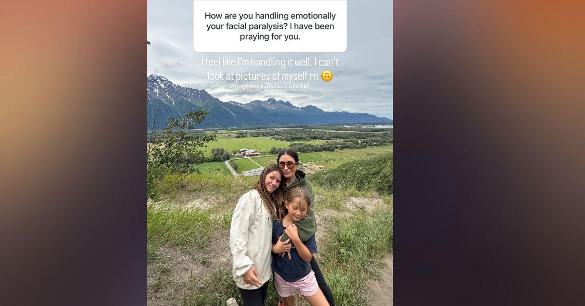 bristol palin facial paralysis
