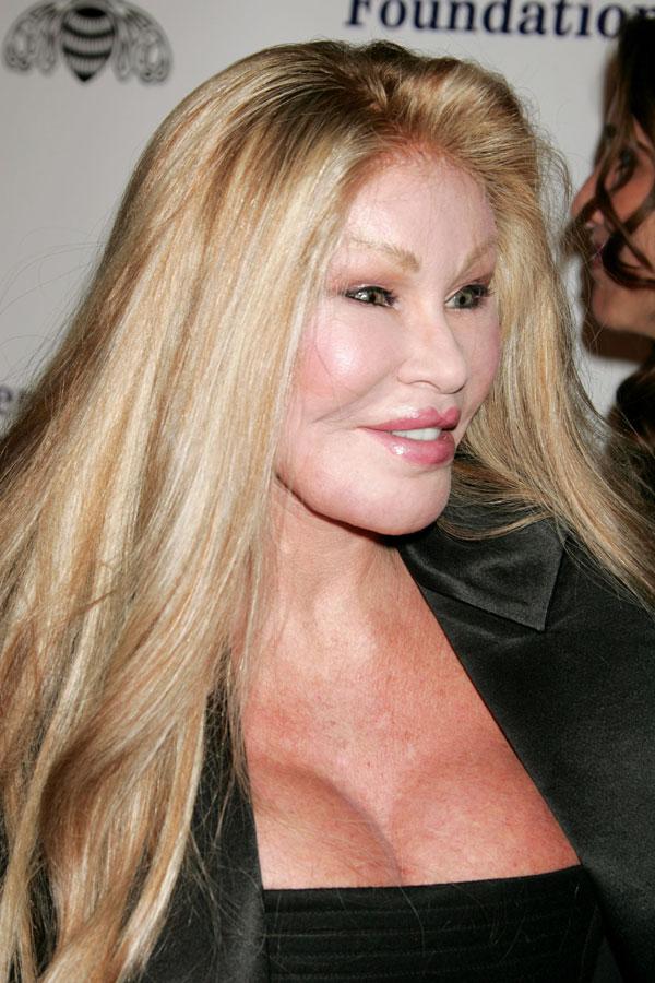 Catwoman jocelyn wildenstein arrested felony assualt 07