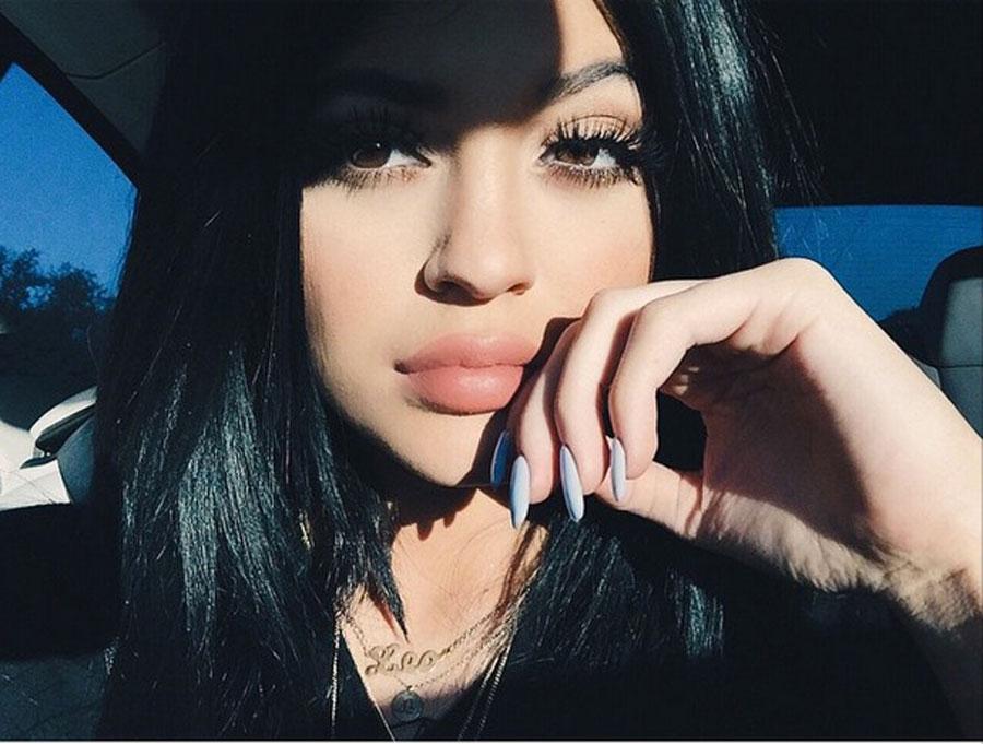 Kylie Jenner Plastic Surgery