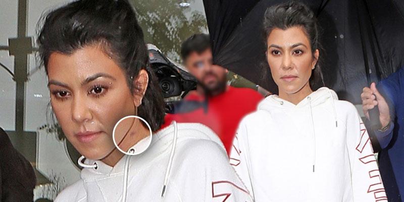 Kourtney kardashian hickey ok pp