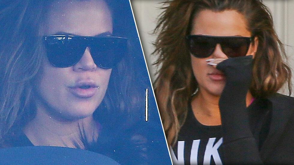 Khloe kardashian lip injections