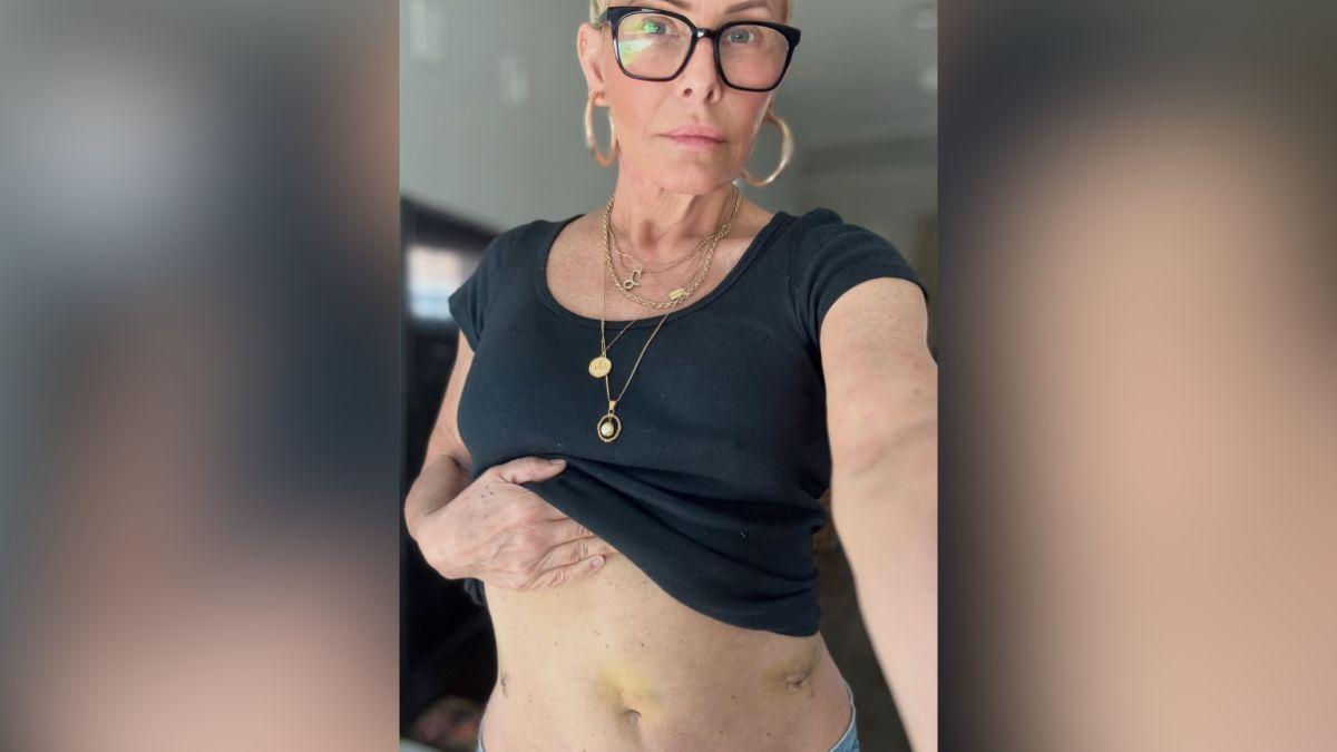 Image of Nicole Eggert was previously diagnosed with b----- cancer.