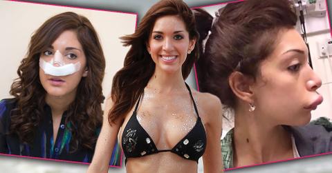 Farrah abraham plastic surgeries 00