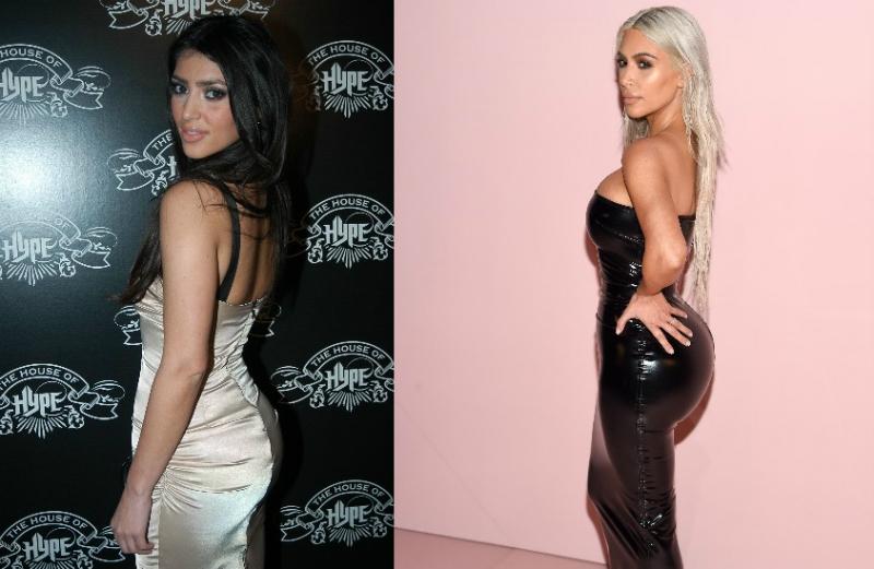 Kim kardashian celebrity plastic surgery