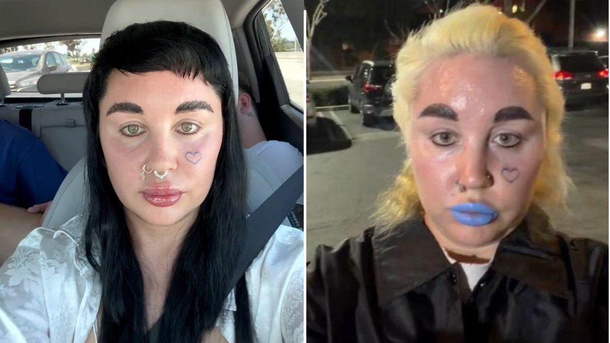 Photo of Amanda Bynes lost 20 pounds in November 2025 after starting Ozempic months earlier.