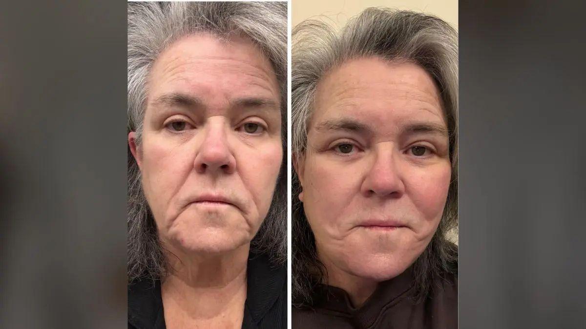 Photo of Alyssa Farah Griffin believes being honest about plastic surgery 'helps a lot of people feel better.'