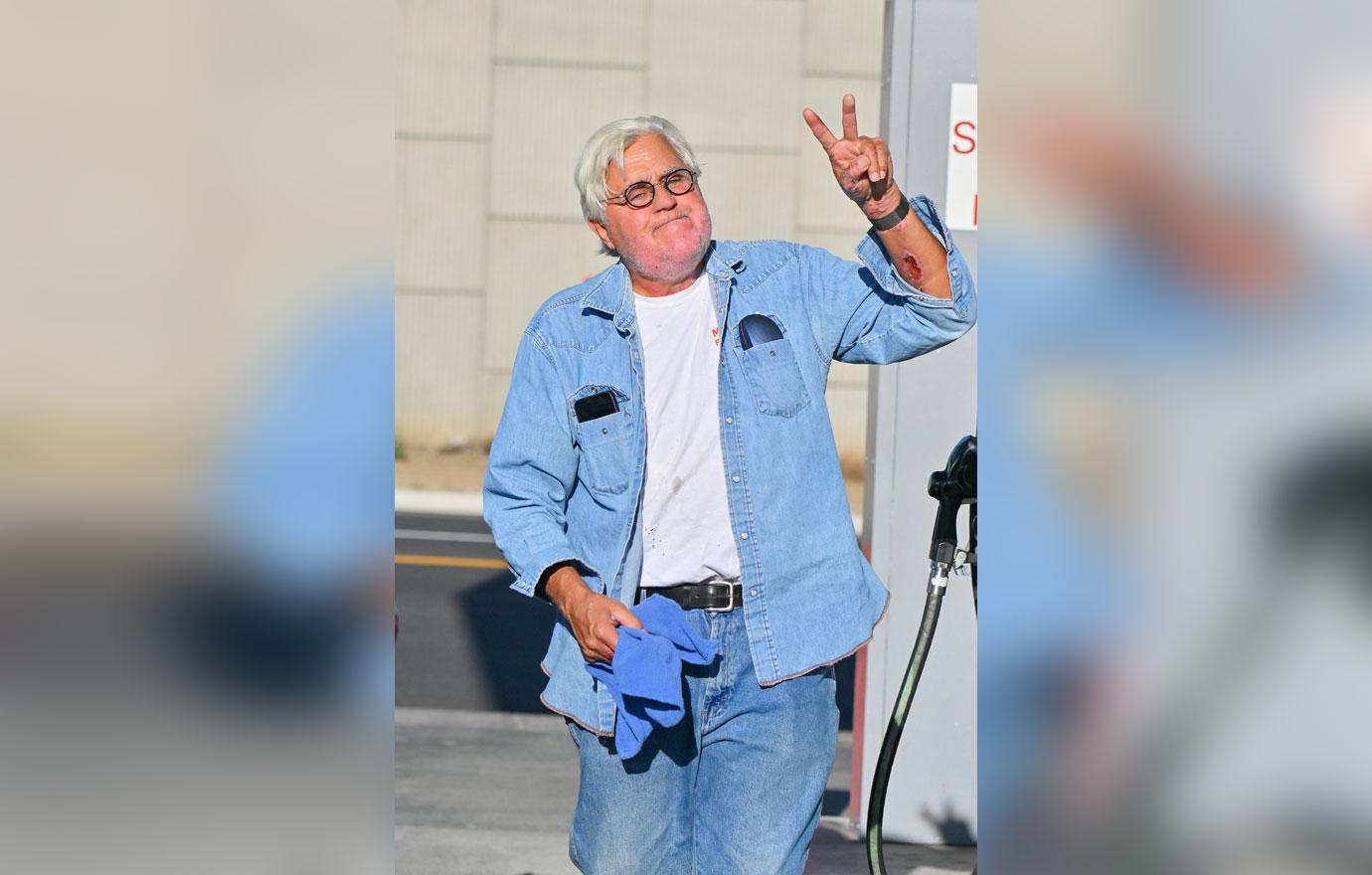 jay leno reveals caused terrifying garage explosion third degree burns