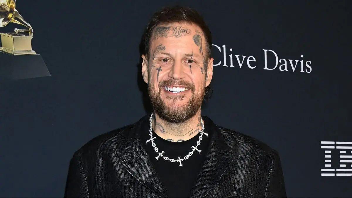 Photo of Jelly Roll has dropped nearly 300 pounds since starting his weight loss journey. 