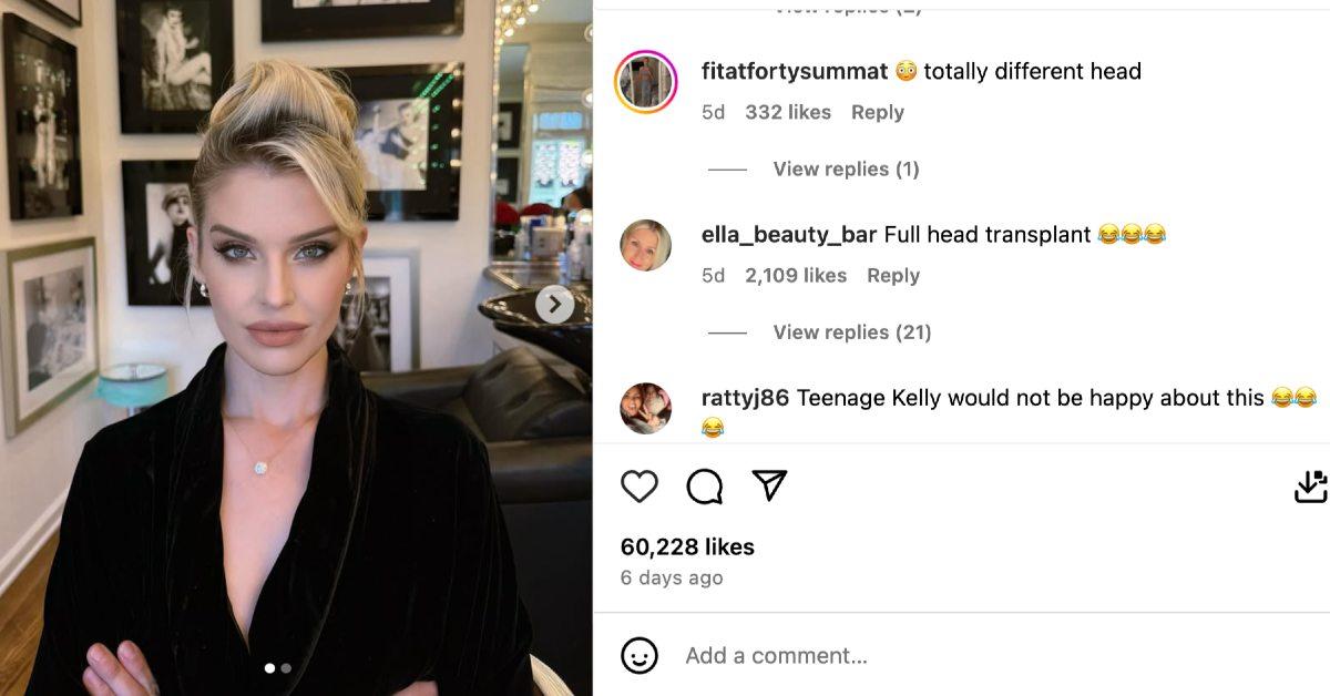kelly osbourne accused undergoing plastic surgery new face photos