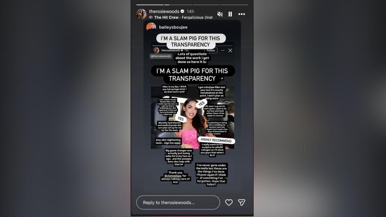 image of Rosie Woods DiMare said she has never undergone cosmetic surgery and explained that her appearance is the result of non-surgical cosmetic treatments.