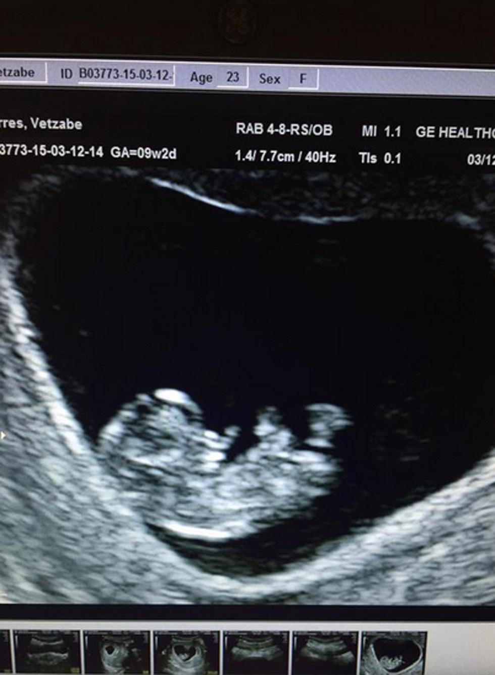 Jo vee baby sonogram