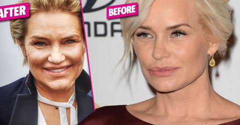 Yolanda hadid no botox plastic surgery before after photos HERO 01