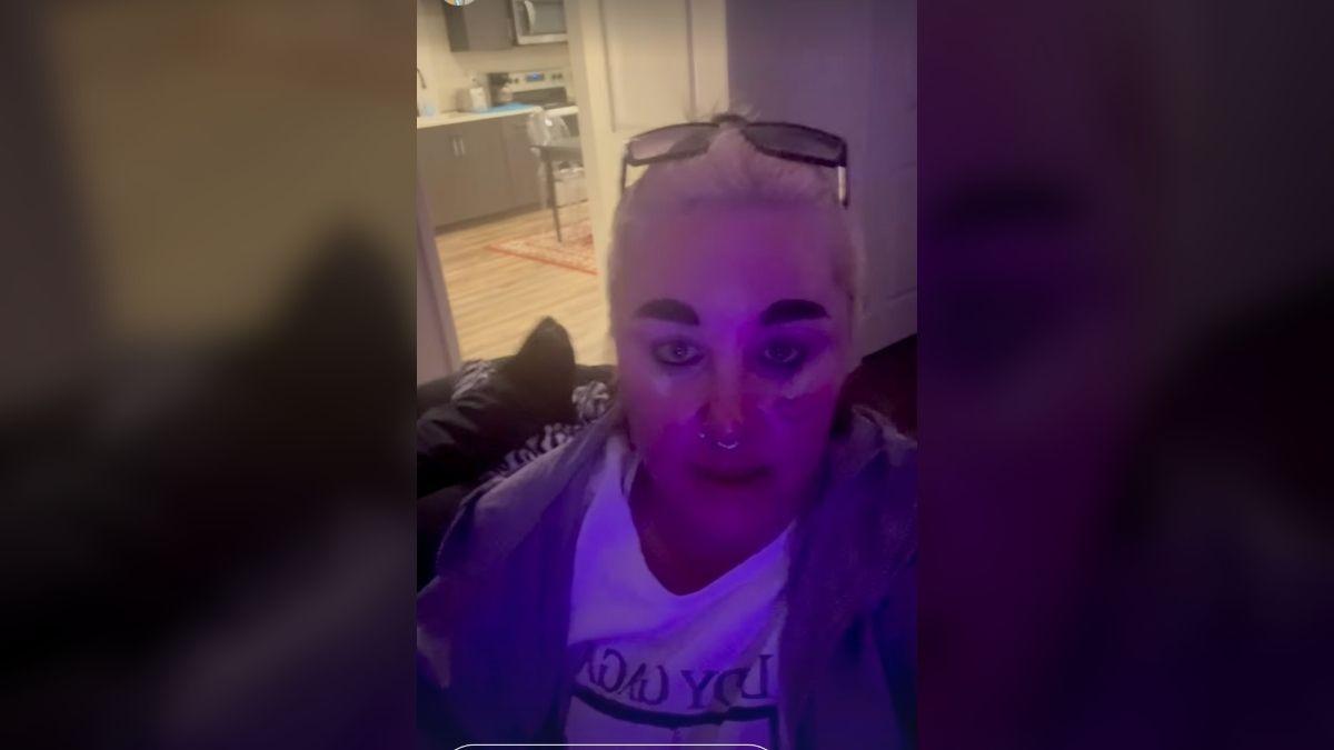 Image of Amanda Bynes has a small heart tattoo on her cheek.