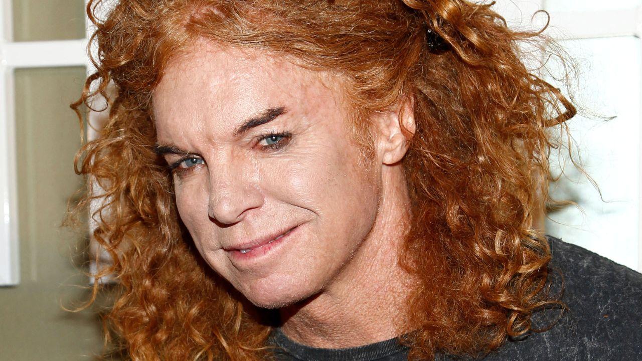 Image of Carrot Top remains hospitalized and recovering following his reported suicide attempt in Las Vegas.