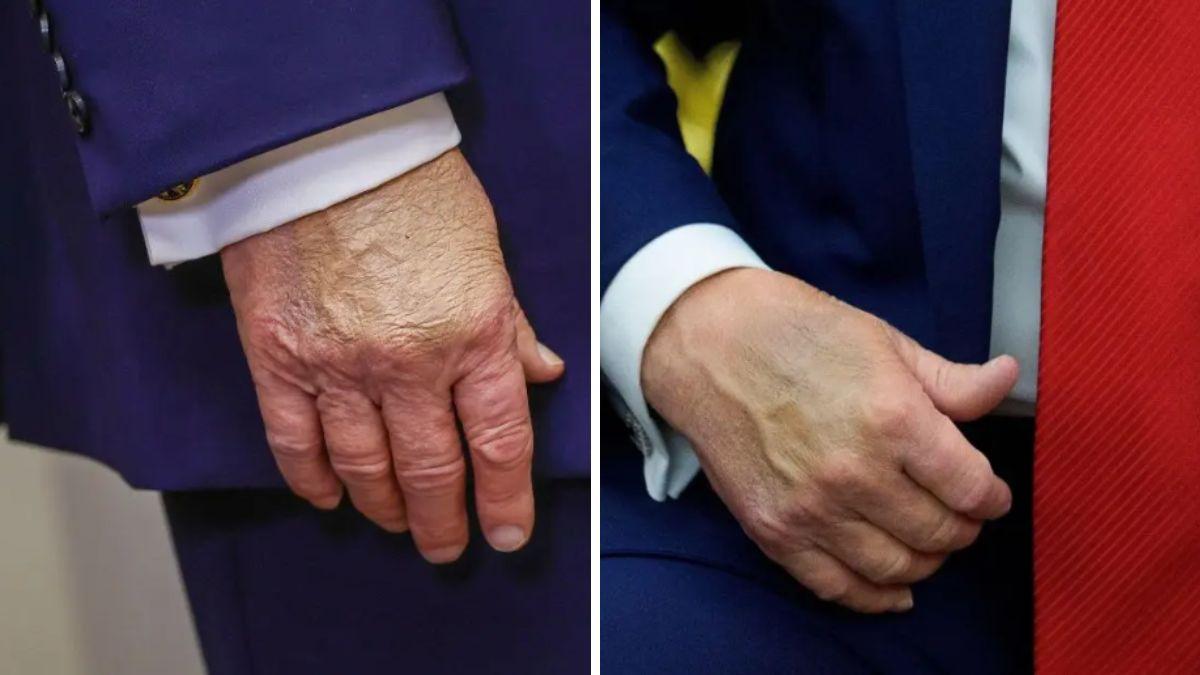 image of Concerns about Donald Trump's health have quietly grown among staffers.