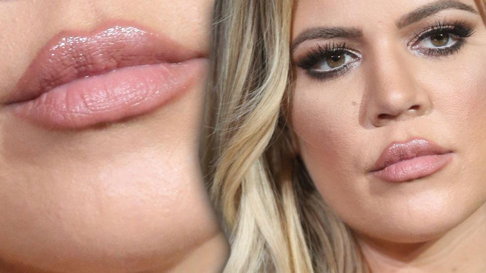 Khloe Kardashian plumped lips