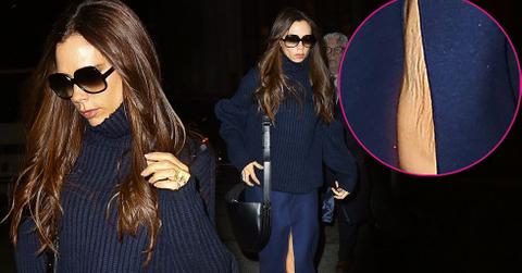 Victoria Beckham David Divorce Rumors Skinny Knee Skin Sag