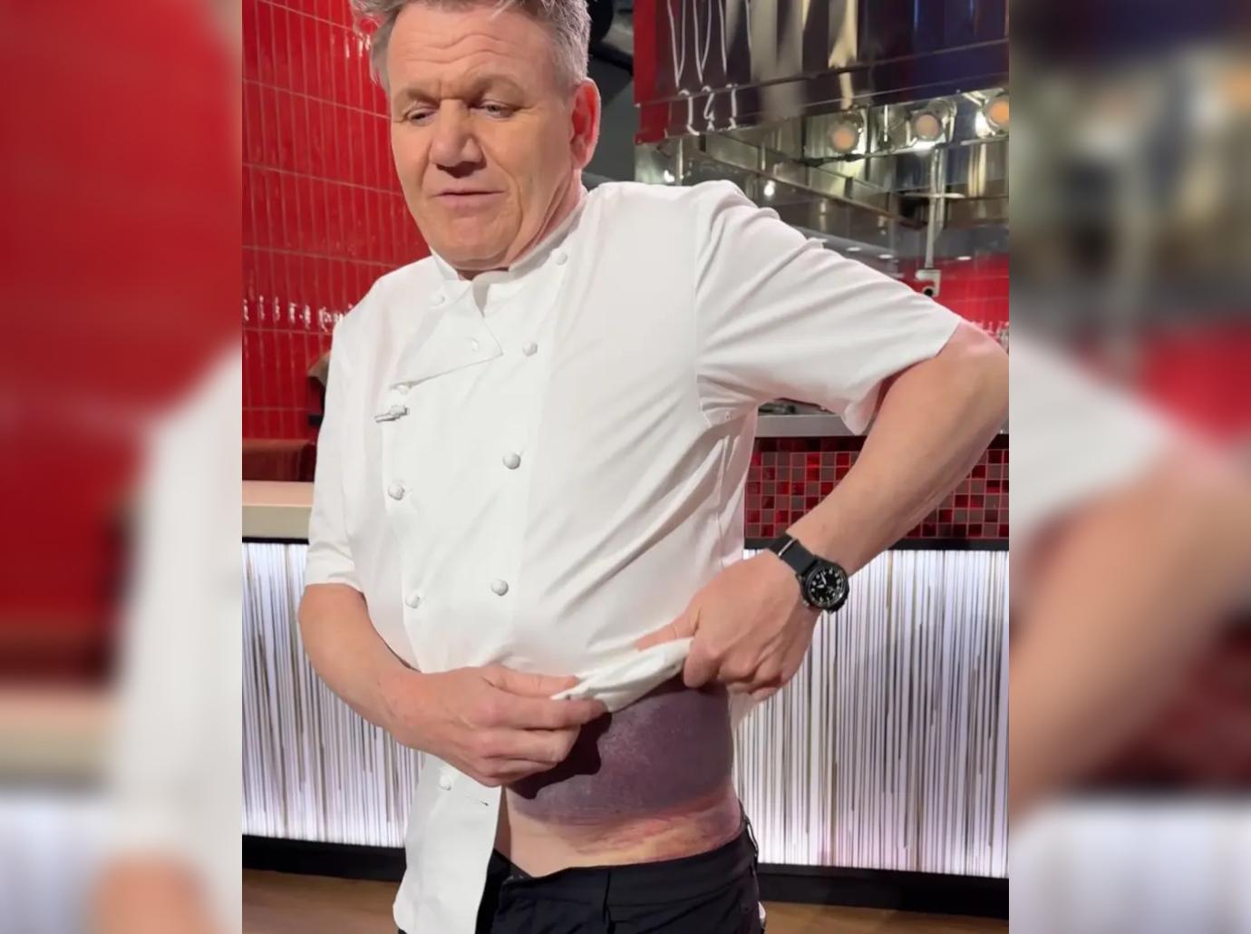 gordon ramsay bike accident underpants assistant embarrassed bruises