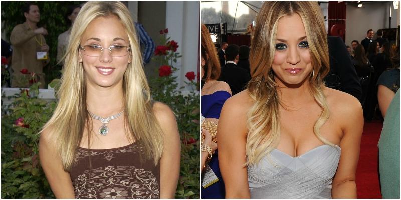 Celebrities with Breast Implants  Before & After Photos - Vantage