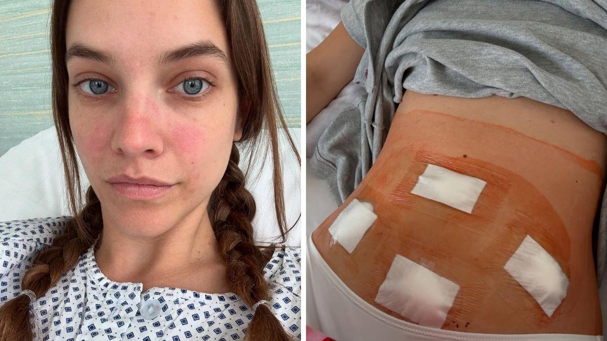 barbara palvin health journey before pregnancy announcement endometriosis diagnosis surgery