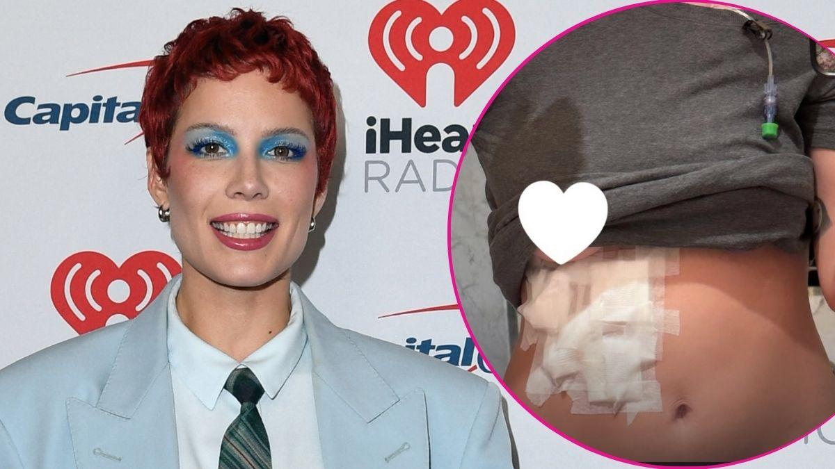 split image of Halsey/ Halsey's torso