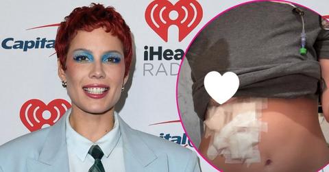 split image of Halsey/ Halsey's torso