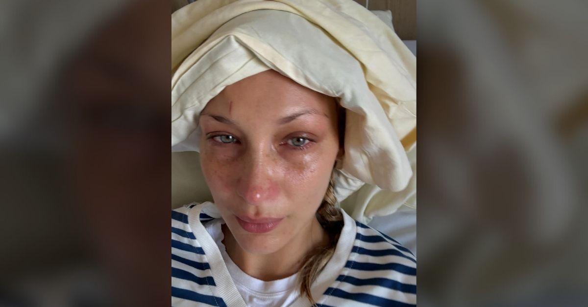 Photo of Bella Hadid alarmed her followers when she shared a photo from a hospital bed. 