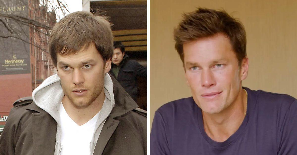 Tom Brady S Changing Face Amid Plastic Surgery Rumors
