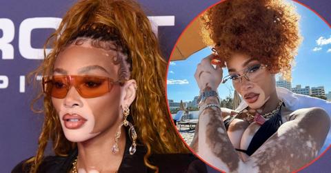 winnie harlow black bikini beach photos