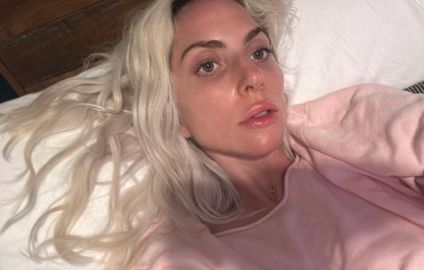 Lady Gaga Slammed By Fans For Promoting Migraine Drug