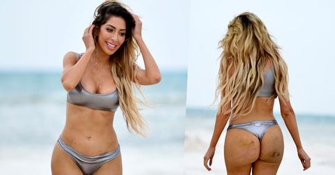 farrah-abraham-thong-butt-injection-bruises-photos-bikini