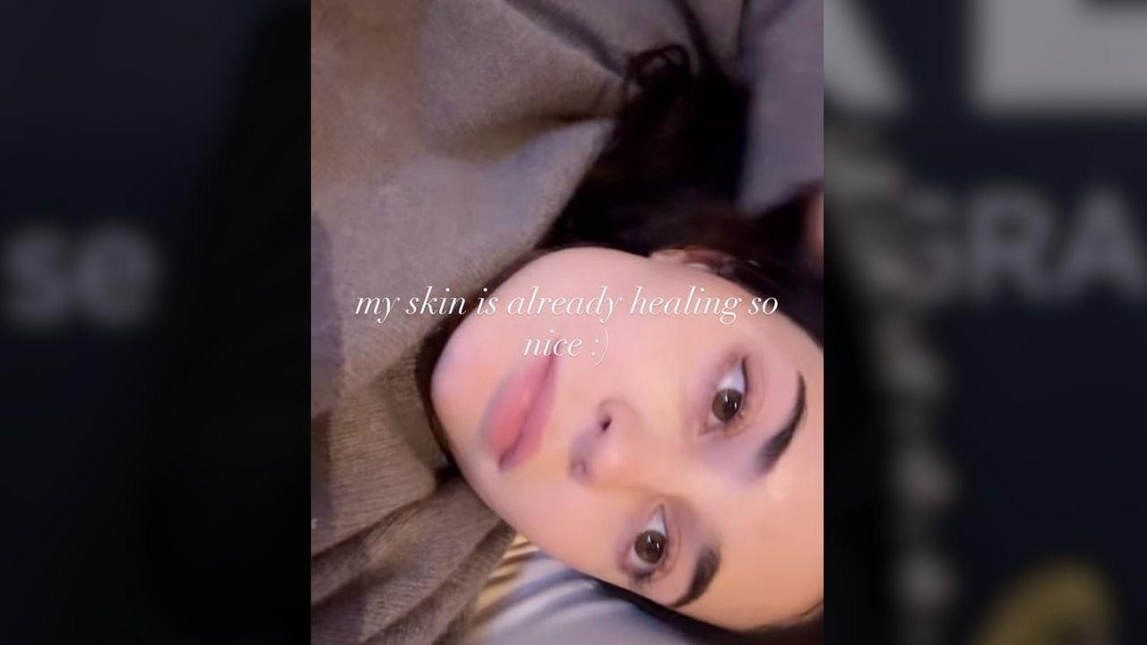 image of Kylie jenner 