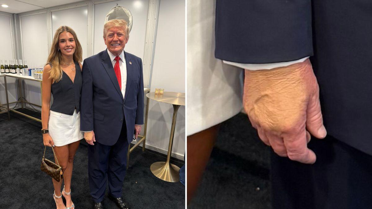 Photo of Social media quickly pointed out Donald Trump's hand, which appeared to covered with makeup.
