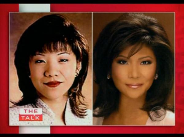 Julie chen plastic surgery