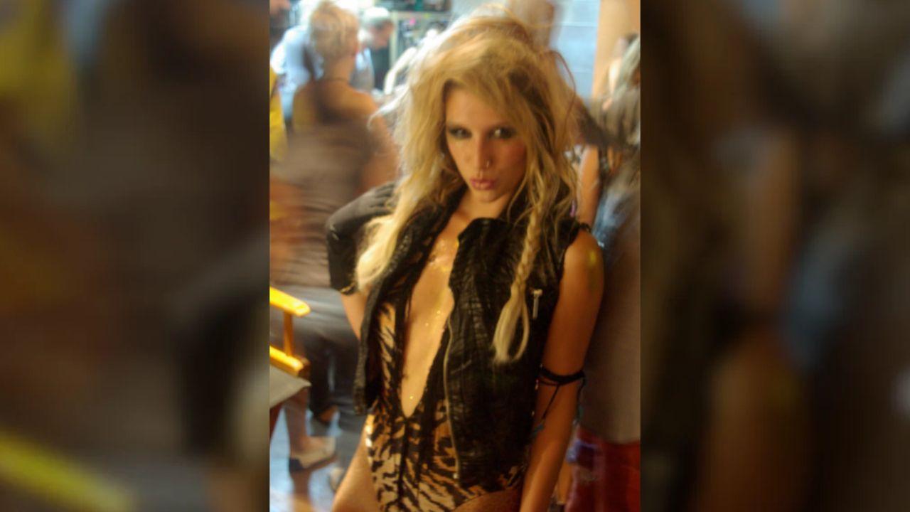 Kesha
