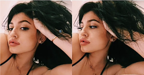 Kylie jenner lip trout pout