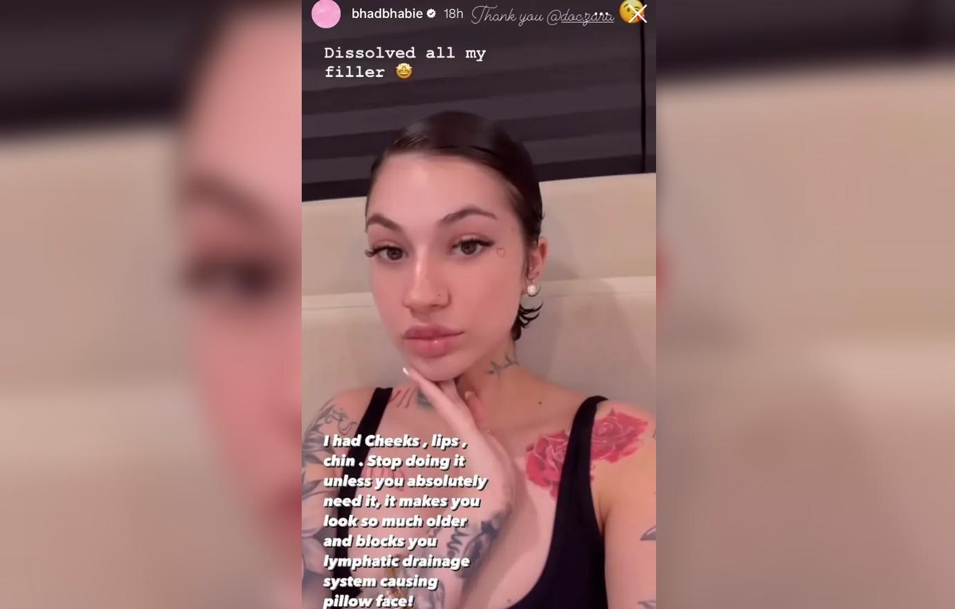 bhad bhabie warns against getting facial fillers dissolving