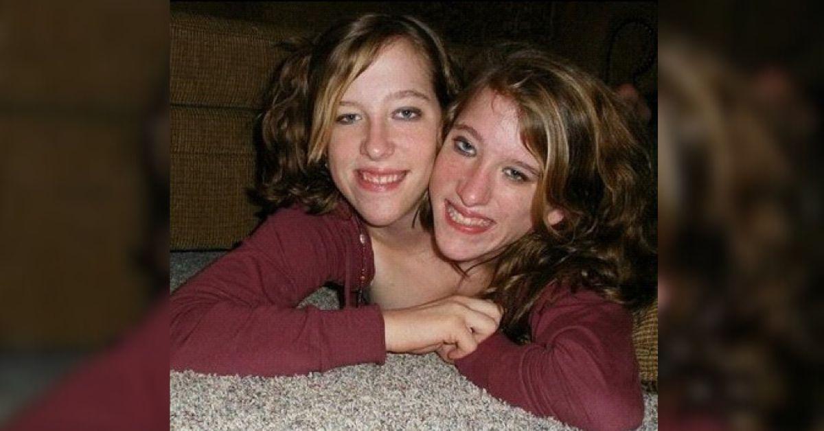 6 Things Know About Conjoined Twins Brittany and Abby Hensel: Their Condition, Work and More
