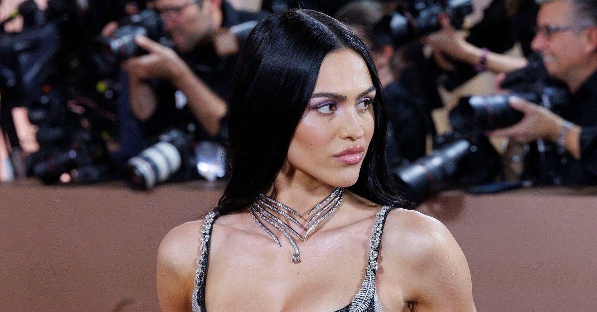 image of The model recently spoke openly about her cosmetic history.