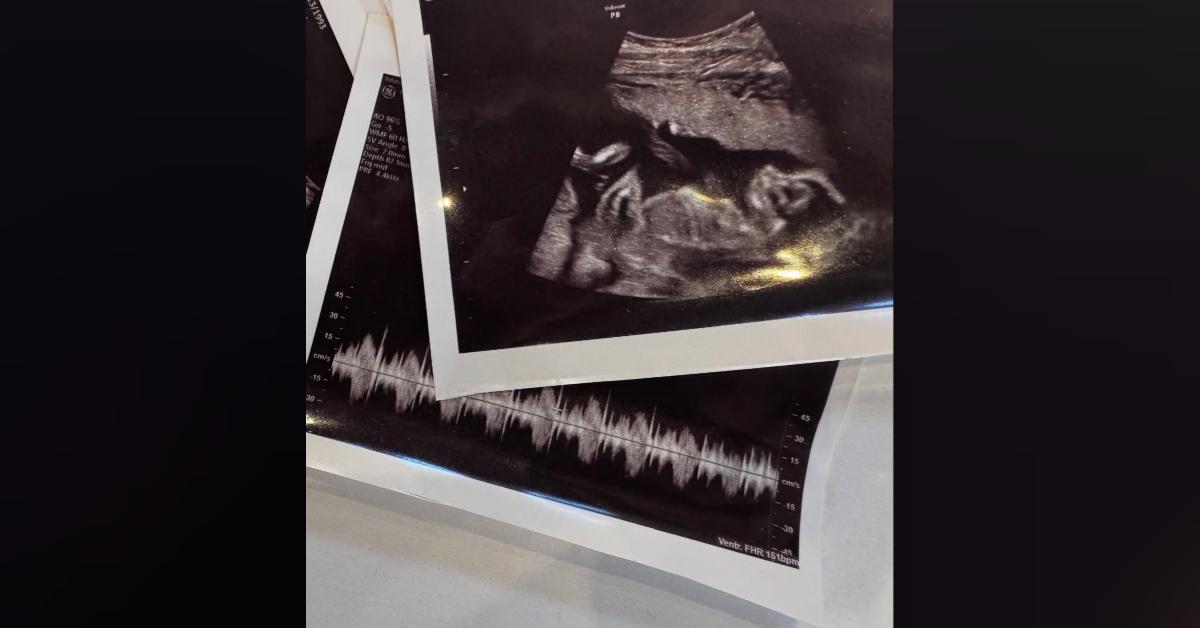 Image of Debby Ryan shared photos of her ultrasound.