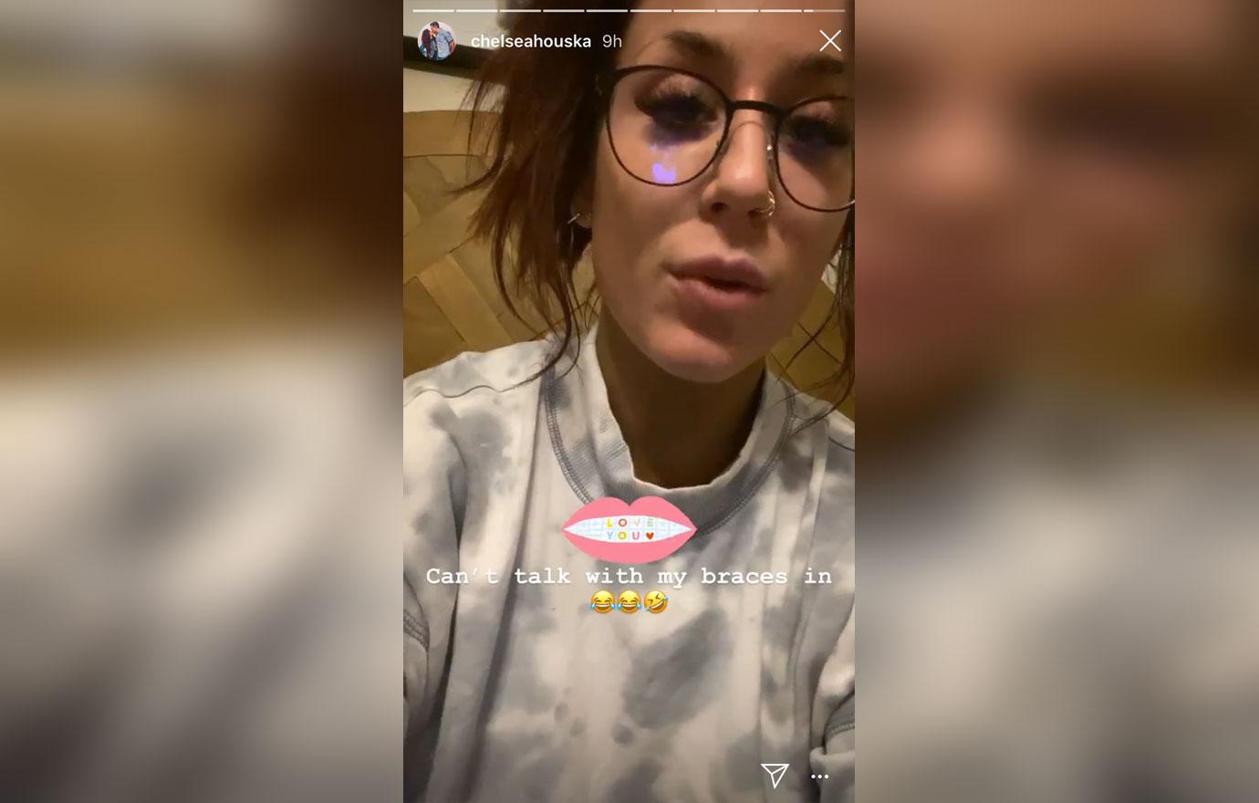 chelsea-houska-instagram-facial-peel-results-video