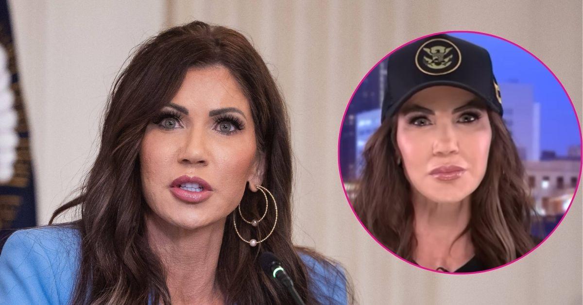 kristi noem mocked botox tv appearance