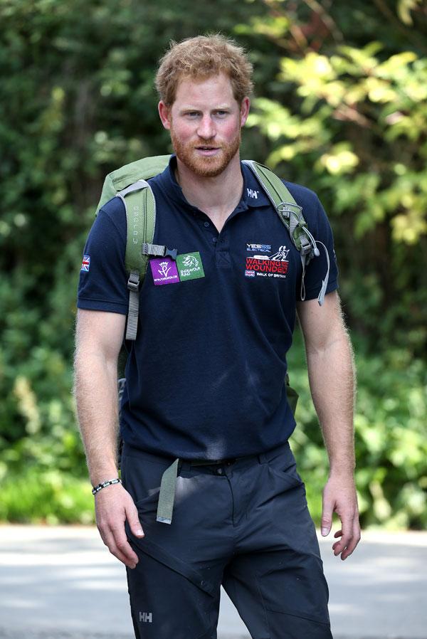 Prince harry hair plugs hair loss issues updates 02