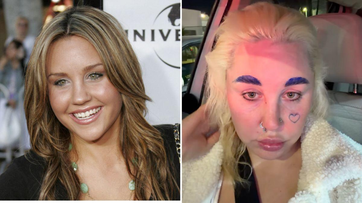 split image of Amanda Bynes and Amanda Bynes